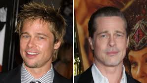 Did Brad Pitt Get Plastic Surgery? Transformation Photos