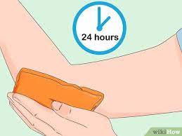 3 Ways To Get Rid Of Bruises Wikihow