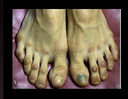 These ballerinas are famous, professional & beautiful these ballerinas are famous, professional & beautiful, but their feet are corny,damaged and ugly. Gross Ballerina Feet Shefalitayal