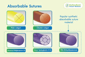Image result for Suture Material
