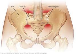 16 Sacroiliitis Ideas Sacroiliac Joint Sacroiliac Si Joint