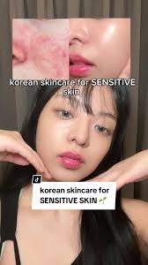 korean skincare for sensitive skin is never complete without centella  asiatica 🍃 try this out if you have sensitive, irritated skin that’s prone  to redness for INSTANT RELIEF @Purito Seoul ...