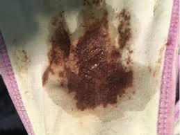 Most of the time, it's nothing to be concerned about. How Normal Is Brown Discharge In Early Pregnancy