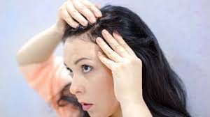 It can be as simple as a thyroid hormone. When Your Hair Won T Cover Your Psoriasis Psoriasis Center Everydayhealth Com