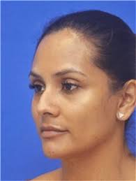 Jonathan R. Berman, MD, FACS