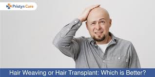 Hair extensions are usually clipped, glued, or sewn on natural hair by incorporating additional human or synthetic hair. Hair Weaving Or Hair Transplant Which Is Better Pristyn Care