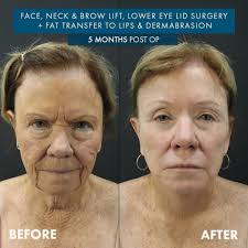 TOP 10 BEST Cosmetic Surgeons in Rosarito, Baja California, Mexico