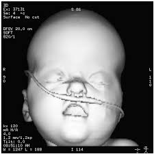 The management and diagnosis of syndromic craniofacial cases