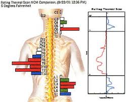 Thermal Scan With The Insight Scanner By Cla Gives Wonderful Insight Into Problem Areas Pediatric Care Chiropractic Care Pediatric Chiropractor