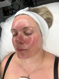 new member here, please welcome nadine lustre