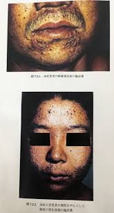 언젠가는 대마왕 1~13권 스캔본 ㅅㅅ. ã‚«ãƒãƒŸ ã‚«ãƒã‚«æ²¹ç—‡ã«æ­£ç¾©ã‚'