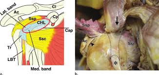The anatomy of the provides the strength and functionality of the upper body. Normal Anatomy Ac Acromion Ssc Subscapularis Tendon Ssp Download Scientific Diagram
