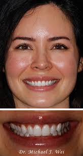 Best Manhattan Cosmetic Dentist in NYC