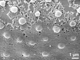 Image result for Stanfieldiella imperforata