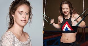 We did not find results for: Champion Gymnast With Down Syndrome Becomes A Stunning Model Paves Way For Others Like Her