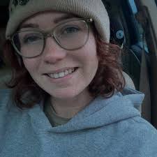 Feeling old and hate the lines around my mouth! Any tips for these? Was  thinking to have fillers! What age do I look? 🙃