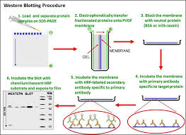 How does western blot work. Western Blot Technique Principle Steps Uses Microbe Online