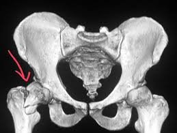 Pin On Ct Scans