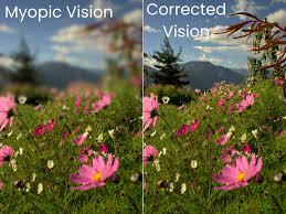 Nearsightedness | Dr Qaisar Ahmed MD, DHMS