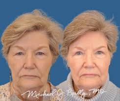 Tough to be saying goodbye today to my fantastic resident, Jason Crossley,  who has been my right-hand man for the last four months. Jason is an  inspiring young surgeon with a tremendous