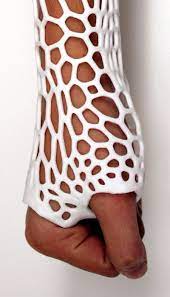 3d Printed Cast 3d Printer 3d Printing Diy 3d Printing Business