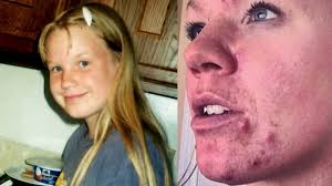 daughter bullied for her appearance