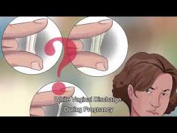 White Discharge During Pregnancy I Patient Education I Mic Youtube