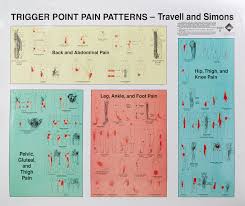 Trigger Point Pain Patterns Wall Charts Amazon Co Uk Janet