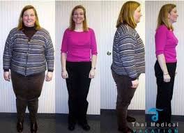 Pin On Awesome Weight Loss Before And After Inspiration Pics