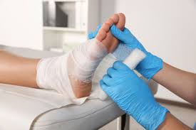 Image result for Wound Dressing
