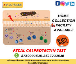 Pin On Dr Lal Path Labs