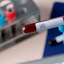 Fiocruz Completes National Production of Dolutegravir, Bolstering Brazil's HIV Treatment Autonomy