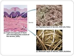 Pin By Phylaine Caring On Integumentary Skin Conditions Thick Skin Layers Of Dermis Skin