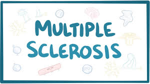 Symptoms of the disease be intermittent (they come and go). How Does Multiple Sclerosis Affect Gait Pattern Article Of The Week 37 Physiospot Physiotherapy And Physical Therapy In The Spotlight