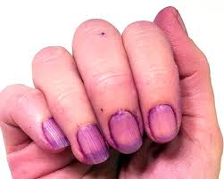 Nail polish remover is only intended for removing dye from your hands as it can be harsh to use on your face or neck. 3 Ways To Remove Splat Hair Dye From The Skin From The Simplest To The Hardest One