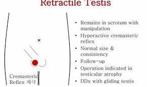 Image result for Cremasteric Reflex