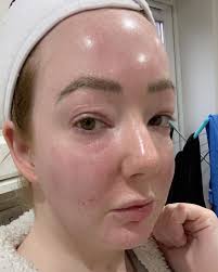 Aesthetics by helen ltd