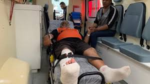 Fotógrafo atingido por bomba em Atlético-MG x Flamengo: Polícia Civil  investiga caso