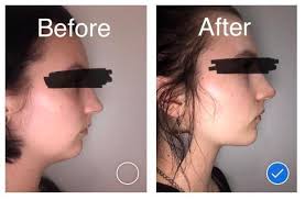 How To Get A Chiseled Jawline The Proven Methods Jawline Exercises Chiseled Jawline Jawline Exercise Face Yoga Facial Exercises