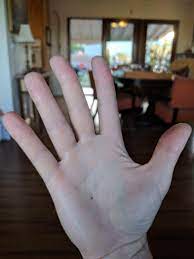 I Have A Freckle On The Palm Of My Hand Funny Animals Freckles Pets