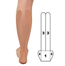 Image result for Taping for Soleus and Achilles