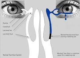 Mr David Cheung Consultant Ophthalmologist Oculoplastic And Orbital Surgeon Specialising In Functional Recons Blocked Tear Duct Eyelid Lift Eyelid Surgery