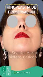 CIRUGIA PLASTICA FACIAL