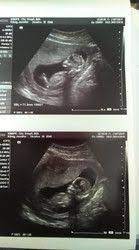Schwanger Mit Zwillingen Gibt Es Noch Werdende Mamis Mit Zwillingen Im Bauch Zum Austauschen Alle Antworten Forum Babyclub De
