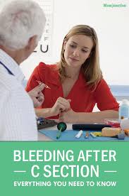 Bleeding After C Section How Long It Lasts And Is It Normal C Section Mom Junction Bleeding