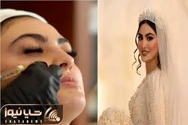 دنیای بازیگران؛ تزریقات زیبایی مریم مومن قبل از عروس شدن