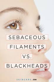 Sebaceous Filaments Vs Blackheads What S The Difference Skincare Com By L Oreal Sebaceous Filaments Blackheads Blackheads On Nose