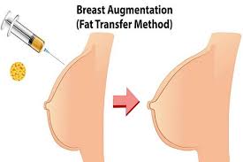 The sono bello cost for stomach, and other similar areas, starts at: Fat Transfer Breast Augmentation Cost In Usa Average Cost And More