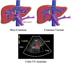 Diagram of the liver is illustrated in detail with neat and clear labelling. Doppler Us Of The Liver Made Simple Radiographics