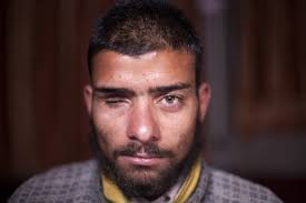 Shot At By A Pellet Gun, Blinded At 17. For The Youth In Kashmir, This Is A  Familiar Story